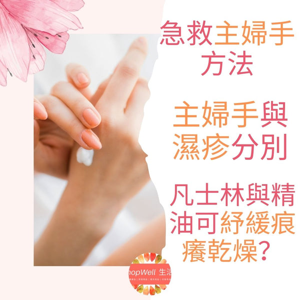 急救主婦手方法｜主婦手與濕疹分別由醫生解構．凡士林與精油可紓緩痕癢乾燥？